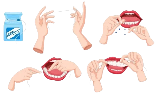 Ilustração mostrando o passo a passo de como usar o fio dental corretamente